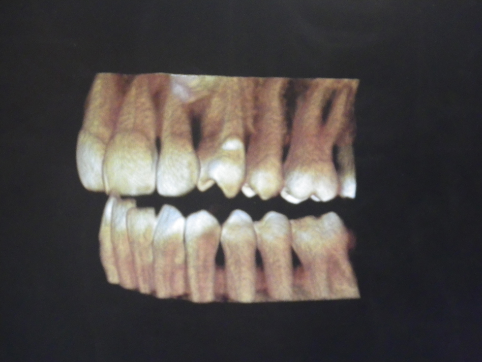 Michael-Riordan-Orthodontics-3d-xray-4